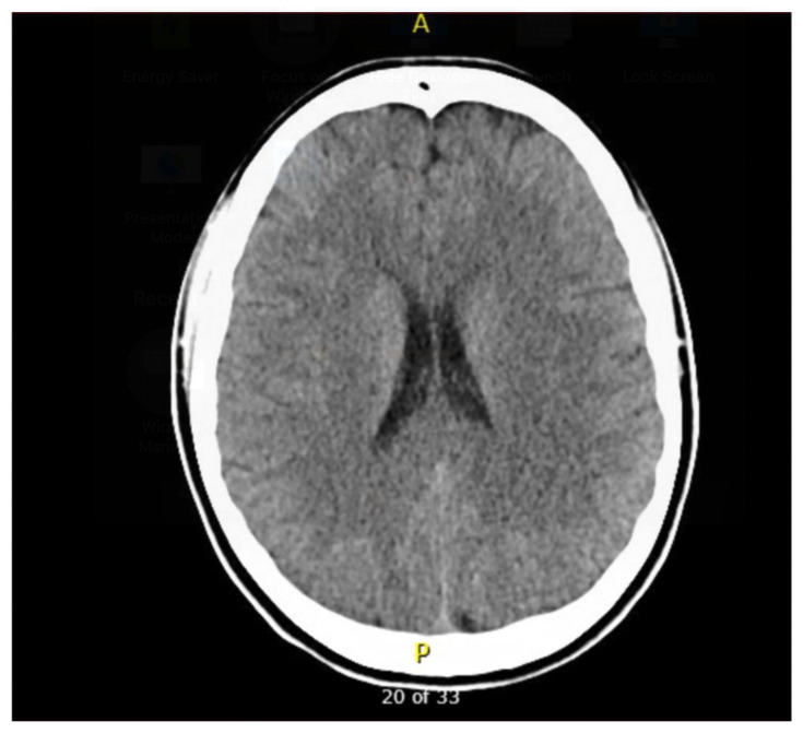 PMC12782603 – f3-jetem-10-5-ce260