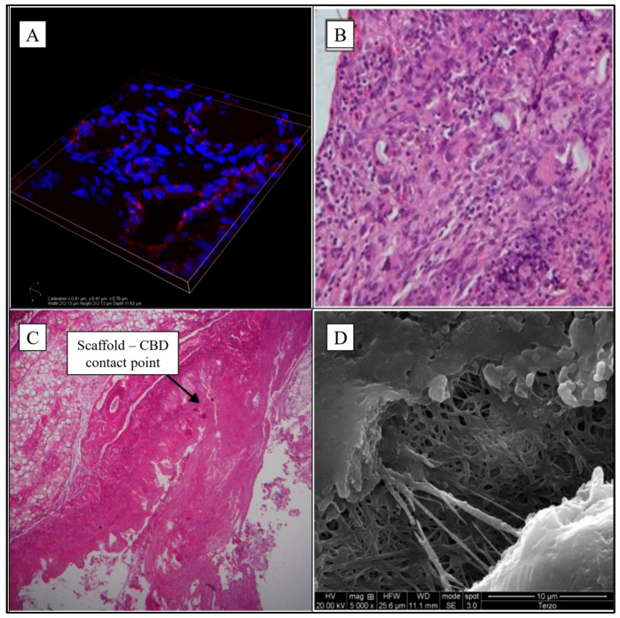 PMC12387130 – jfb-16-00297-f001
