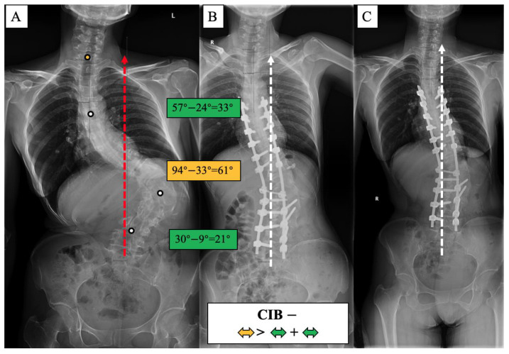 PMC10301802 – jpm-13-00897-f007