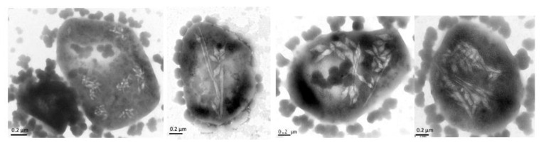 PMC9501494 – life-12-01455-f004