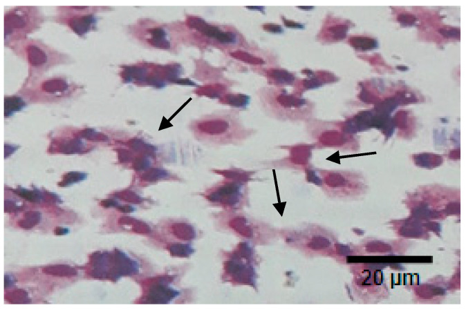 PMC7997376 – marinedrugs-19-00133-f008