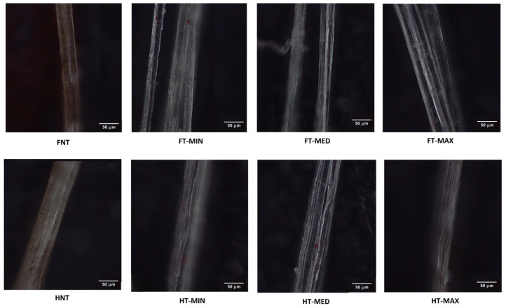 PMC13117913 – materials-19-01573-f011