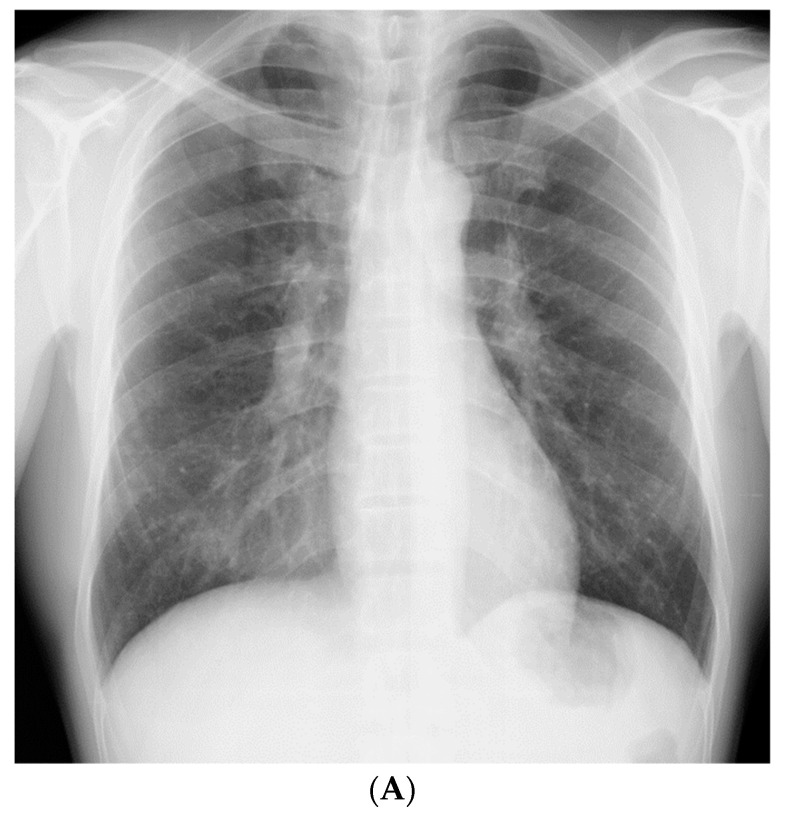 PMC7700418 – medicina-56-00630-f001