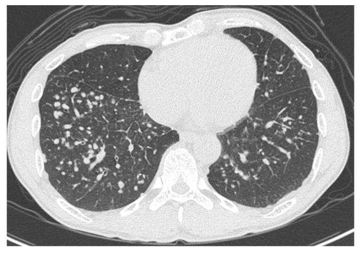 PMC7700418 – medicina-56-00630-f002