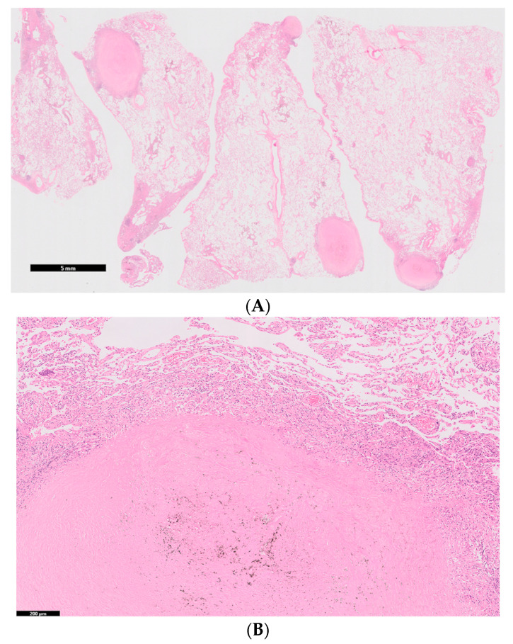 PMC7700418 – medicina-56-00630-f003