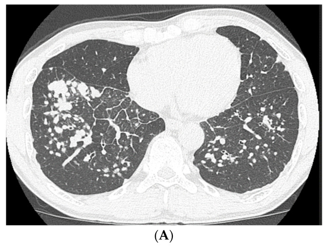 PMC7700418 – medicina-56-00630-f005