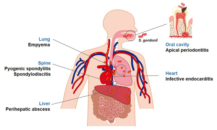 PMC7761167 – microorganisms-08-01852-f002