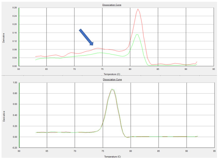PMC8875355 – microorganisms-10-00341-f001