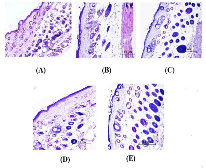 PMC8879523 – nanomaterials-12-00636-f004