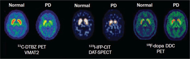 PMC10567584 – neurosci-10-03-017-g006