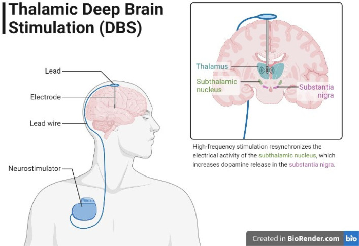 PMC10567584 – neurosci-10-03-017-g007