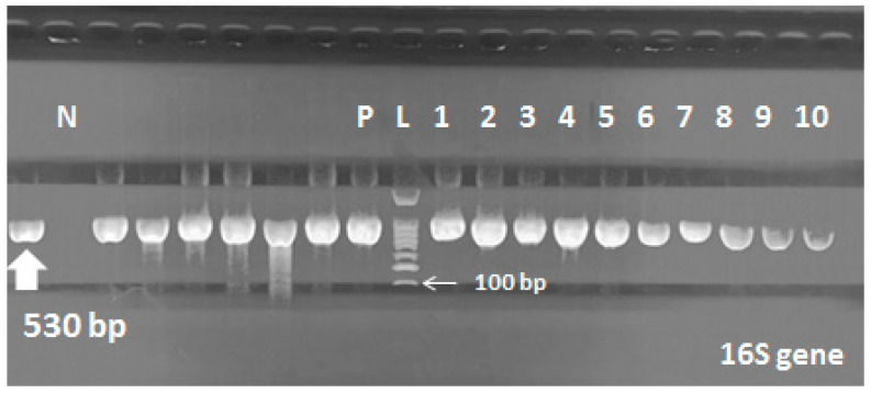 PMC7350317 – pathogens-09-00471-f002