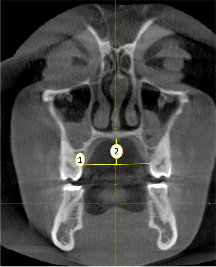 PMC11430163 – fig-3
