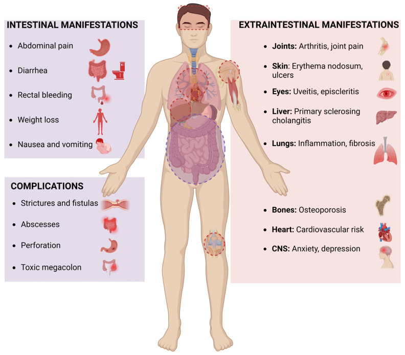 PMC12030576 – pharmaceuticals-18-00478-f001
