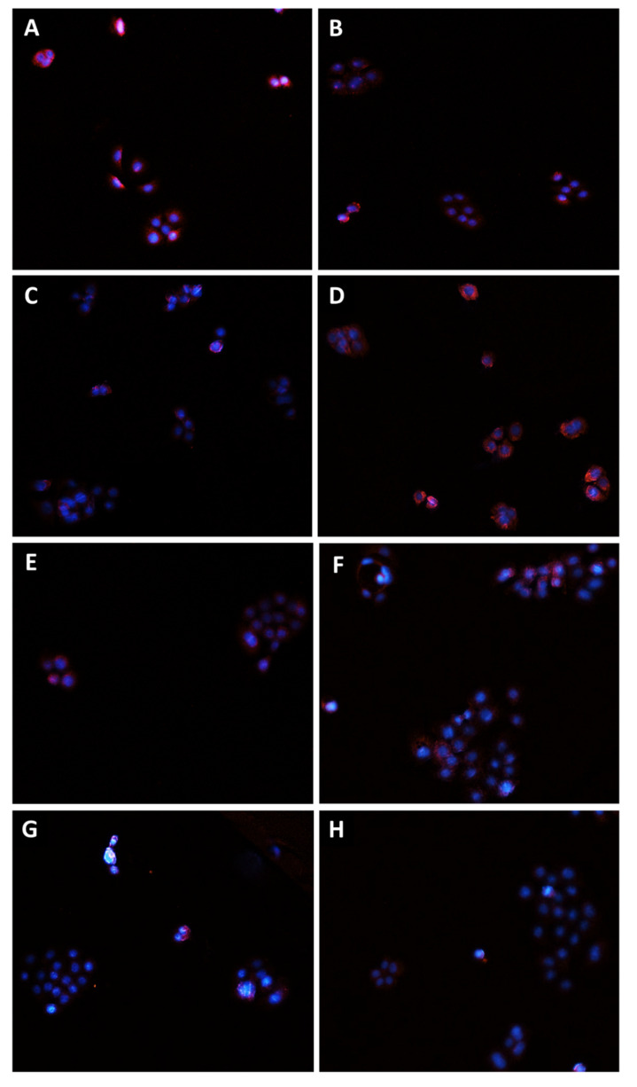 PMC9231089 – pharmaceutics-14-01264-f010