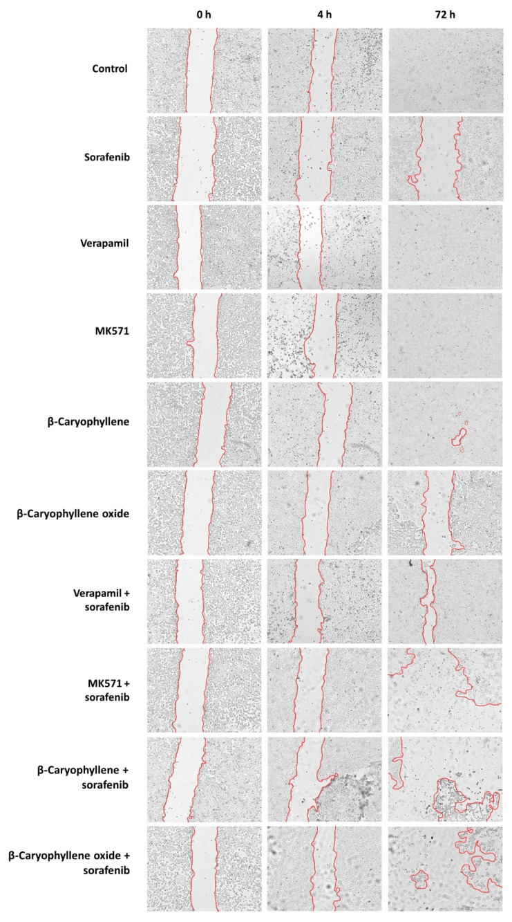 PMC9231089 – pharmaceutics-14-01264-f014