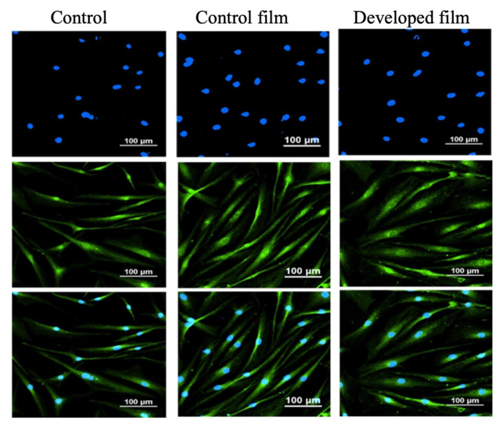 PMC10747745 – pharmaceutics-15-02682-f006