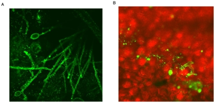 PMC3160888 – pone-0023555-g004