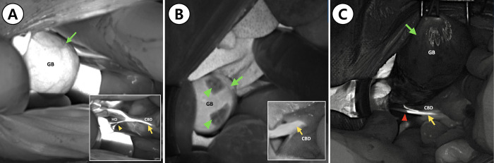 PMC11111041 – pone.0300395.g003