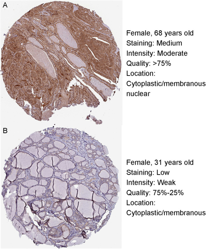 PMC12058196 – pone.0323013.g002