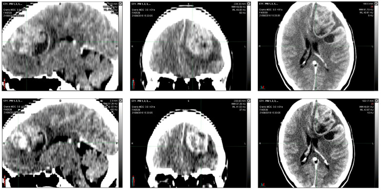 PMC12225241 – reports-06-00022-f001