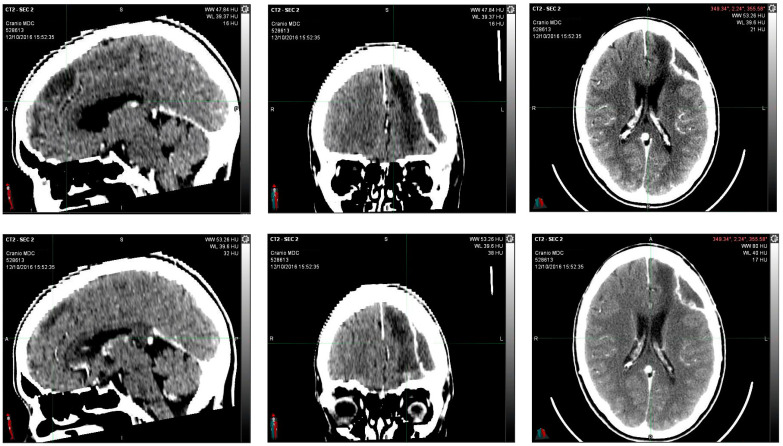 PMC12225241 – reports-06-00022-f002