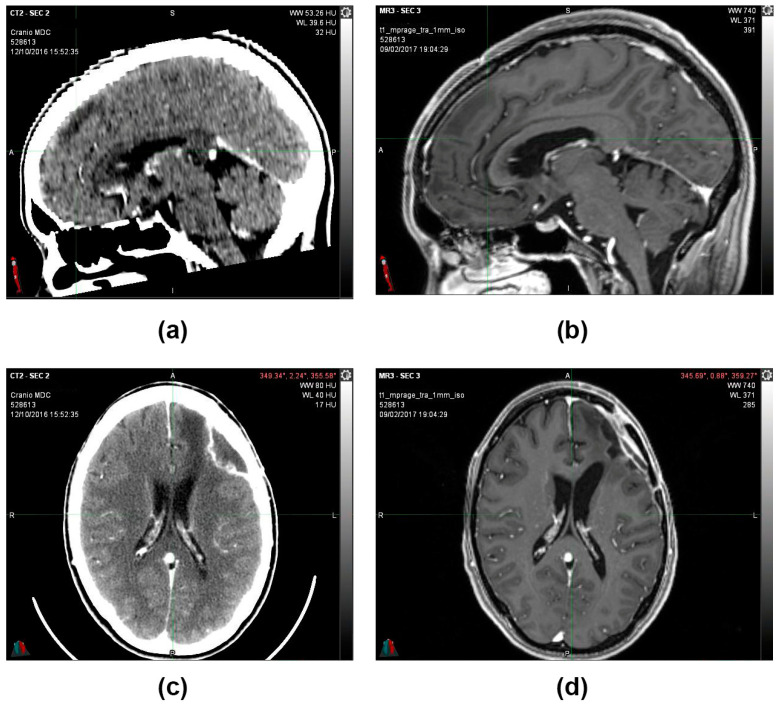 PMC12225241 – reports-06-00022-f003