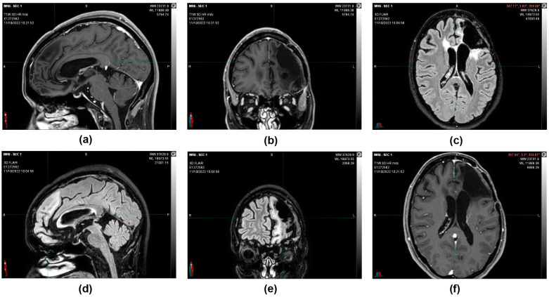 PMC12225241 – reports-06-00022-f004