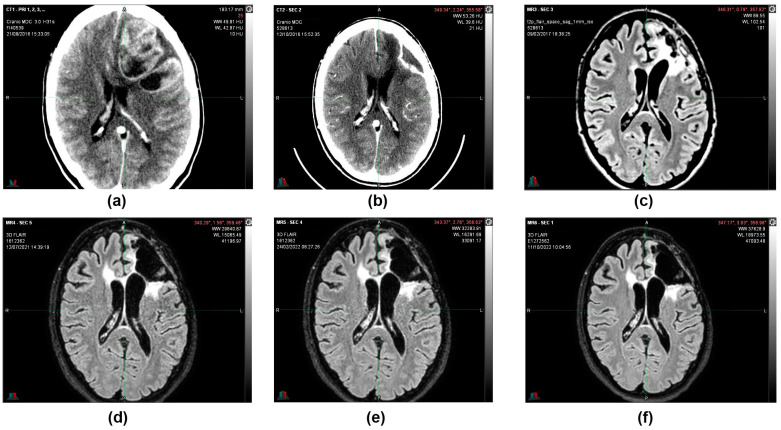 PMC12225241 – reports-06-00022-f005