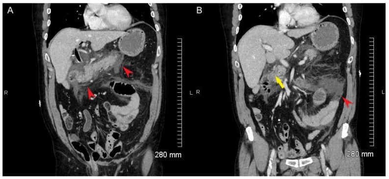 PMC9785686 – tomography-08-00248-f001