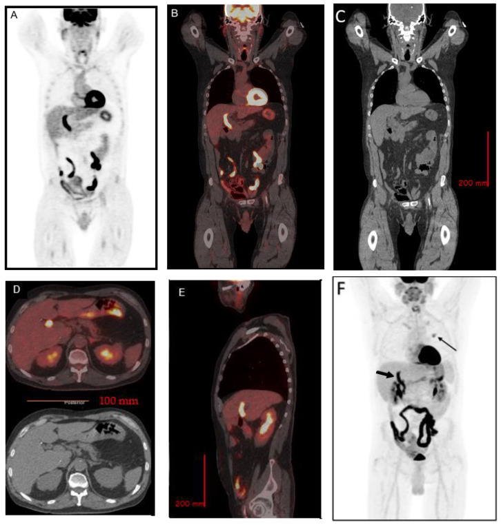 PMC9785686 – tomography-08-00248-f002
