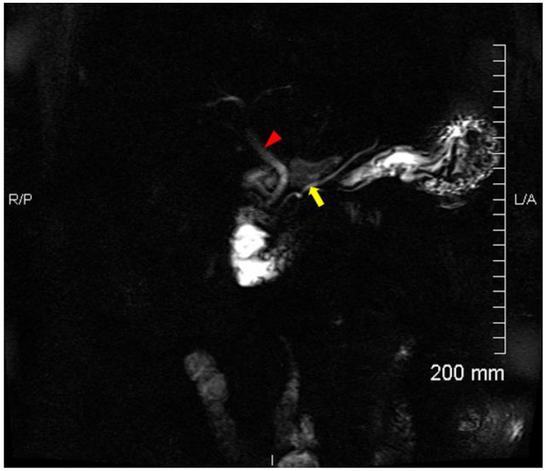 PMC9785686 – tomography-08-00248-f003