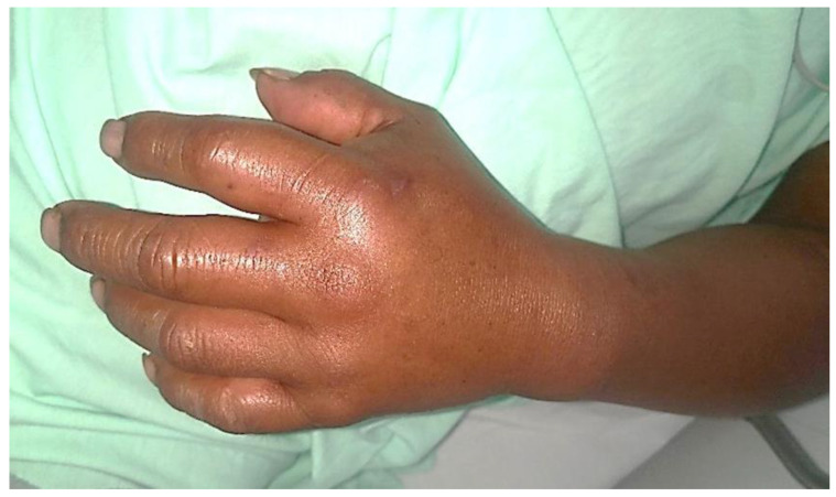 PMC9784998 – toxins-14-00875-f002