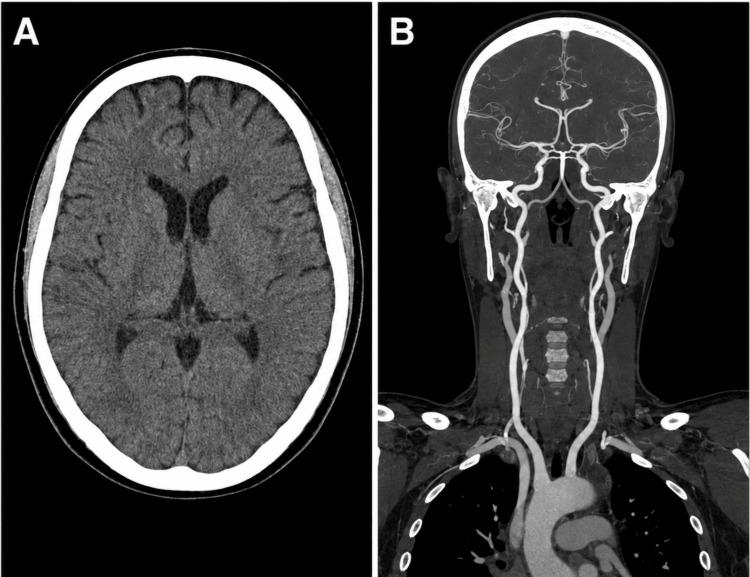 PMC13294481 – FIG1