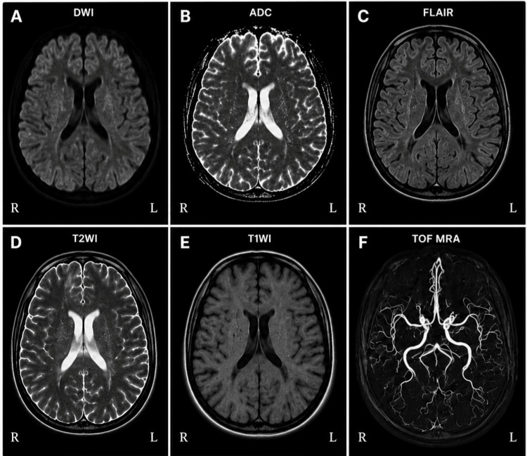 PMC13294481 – FIG2