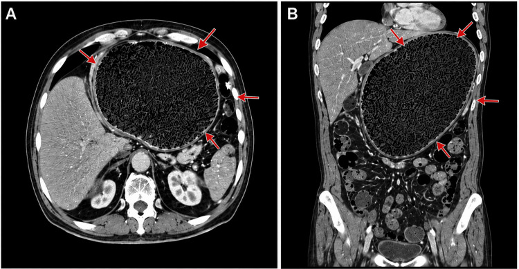 PMC13294481 – FIG3