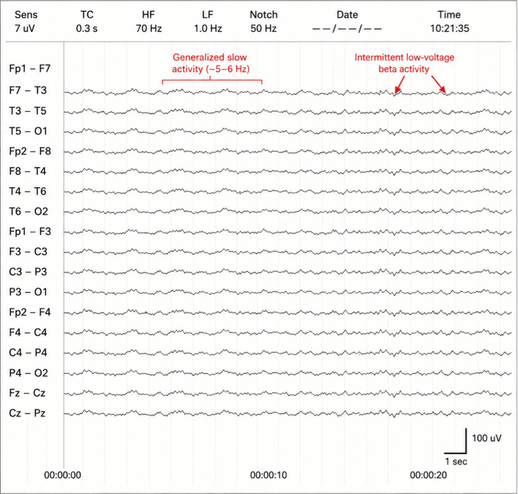 PMC13294481 – FIG5