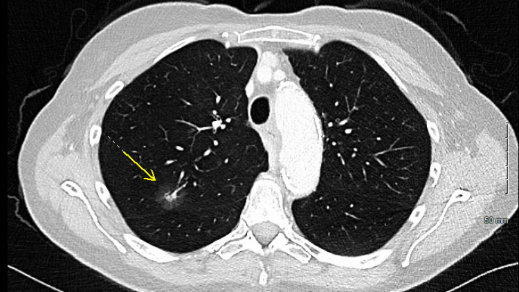 PMC13402928 – FIG1