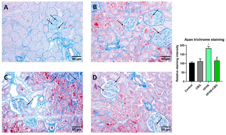 PMC13362918 – nutrients-18-02063-f007