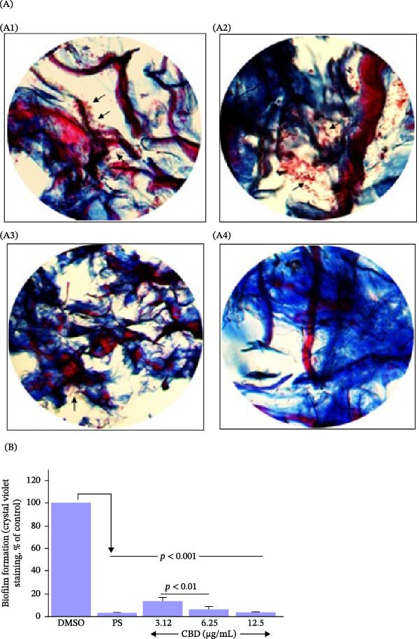 PMC13469321 – fig-0006
